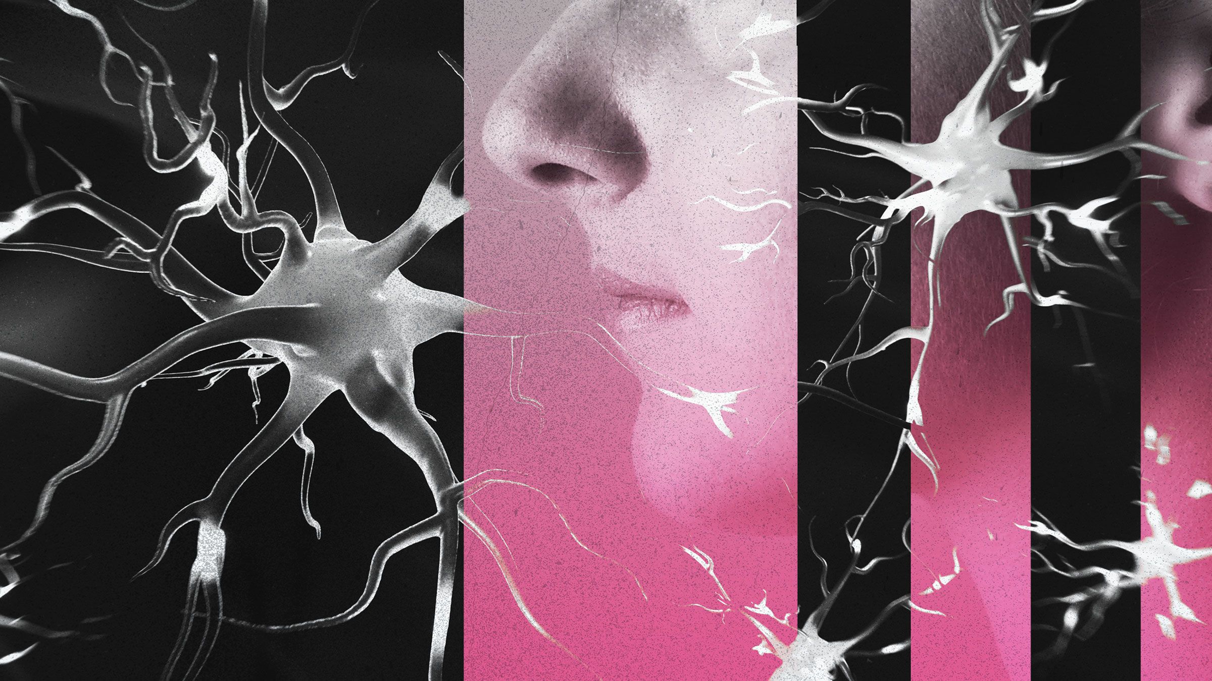 A Key to Detecting Brain Disease Earlier Than Ever.